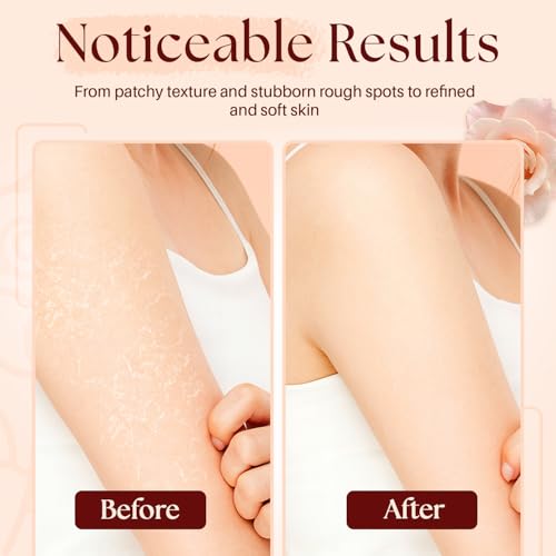 Megababe Bumpy Bar | Pre-Shave Exfoliating Scrub | with Shea Butter, Strawberry Fruit Extract & Ceramides | 4.5 oz