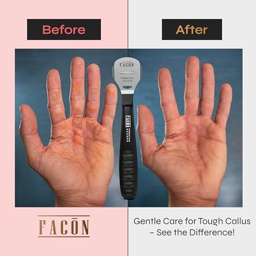 FACON Professional Callus Shaver with 50 Blades for Feet & Hands