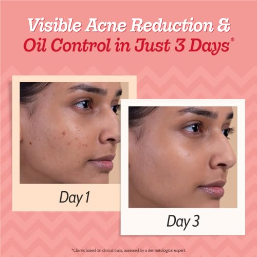 Chemist at Play Salicylic Acid 30ml Face Serum for Acne & Oil Control