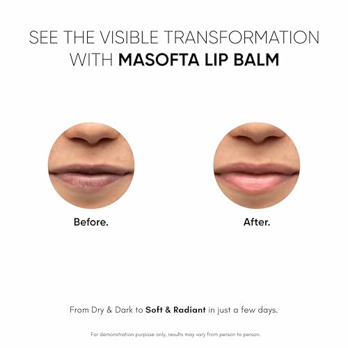 Masofta Kojic Acid & Shea Butter Lip Balm with SPF 30 - 15g