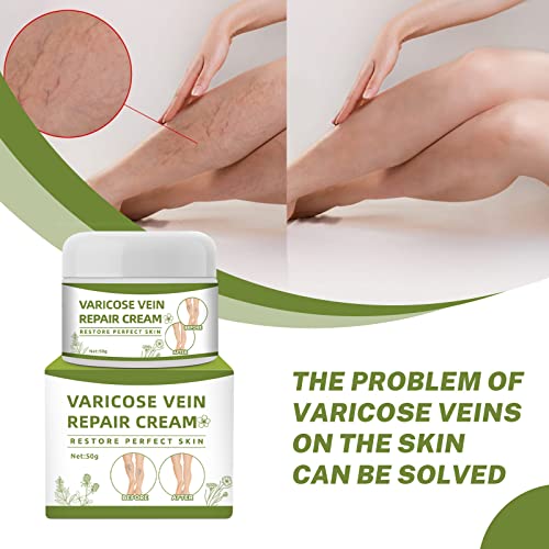 Varicose Veins Repair Cream - Leg Spider Vein Treatment Treatment 50g