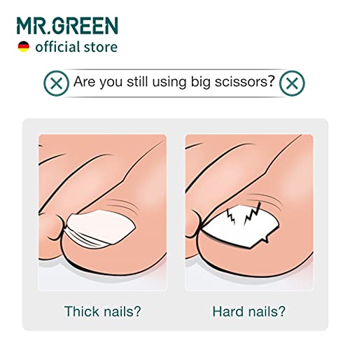 MR.GREEN Purple Toenail Clipper - Stainless Steel Ingrown Nail Cutter