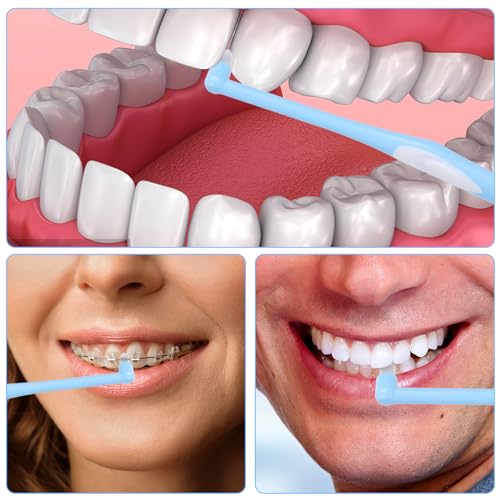 Ouligay 4-Pack Single Tuft Toothbrush Set for Braces & Detail Cleaning