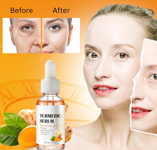 Kurchugo Turmeric Serum — Dark Spot Corrector for Face & Body, 1 Fl Oz