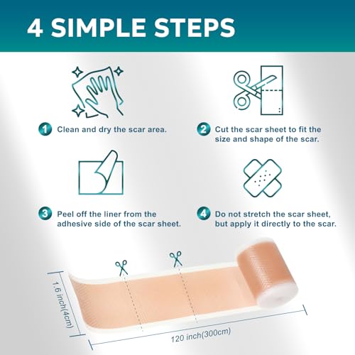 UNIEDI Silicone Scar Sheets - 1.6" x 120" Roll for Surgical & Keloid Scars