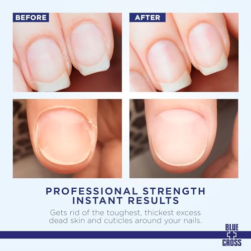 Blue Cross Cuticle Remover Cream - Moisturizing Nail Softener, 4oz
