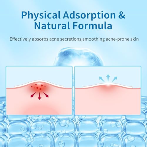 180 Count Hydrocolloid Acne Patches with Tea Tree Oil