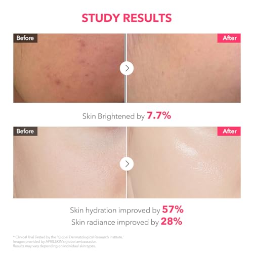 APRILSKIN TXA Pink Capsule Gel Mask - Overnight Hydrating Mask for Uneven Skin Tone, 30g