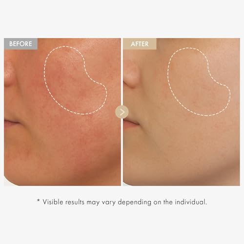 TOSOWOONG Rice Glow Serum for Dark Spots & Dull Skin - Brightening & Hydrating