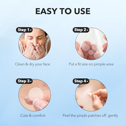 QUSTERE Hydrocolloid Pimple Patches for Face - 800 Count, 4 Sizes