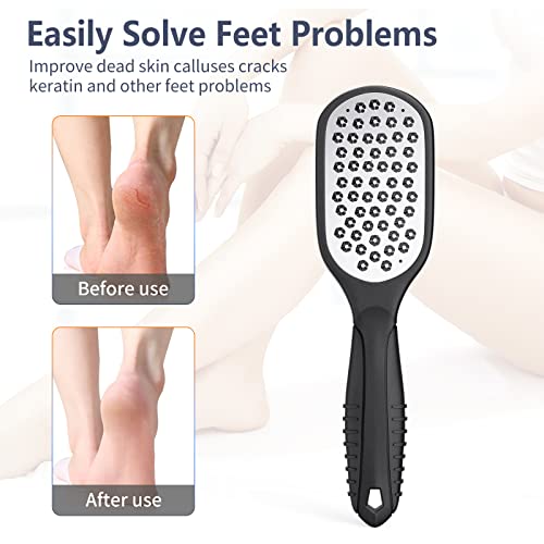 Stainless Steel Foot File & Callus Remover for Smooth Feet