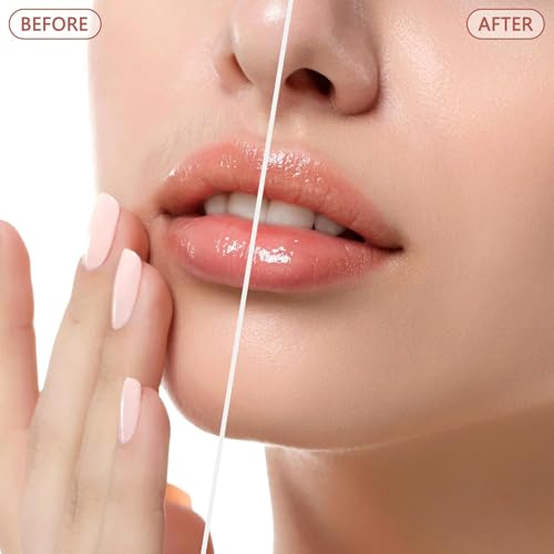 Rechargeable Rose Gold Facial Hair Remover for Women with LED Light & 1 Replacement Head