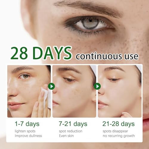 Crema para Manchas Oscuras en la Cara – 2 PCS, Eliminación de Pecas y Manchas
