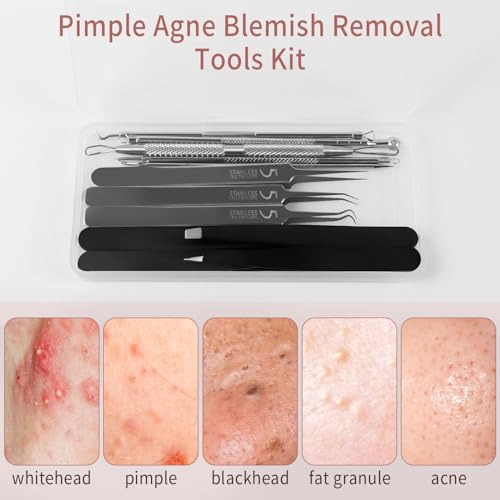 Blackhead Remover Tool Kit - 12 Piece Pimple Popper & Tweezers Set
