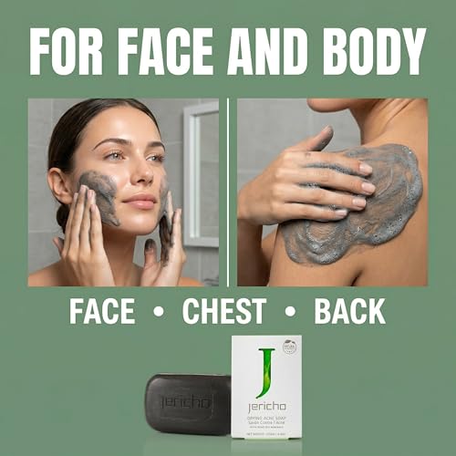 Jericho Acne Drying Bar Soap Pack of 1 - Dead Sea Mineral Facial & Body Cleanser for Oily Skin, Teens & Adults