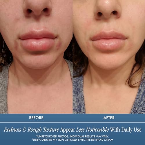 Admire My Skin Retinoid Cream for Face - Anti-Aging Moisturizer