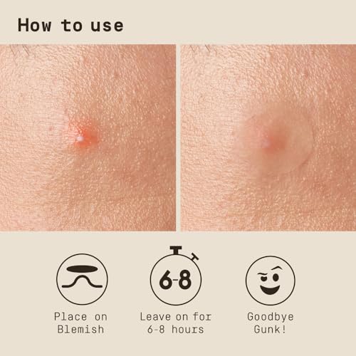 PAPATUI Men’s Hydrocolloid Pimple Patches - Acne Spot Treatment, 36 Count