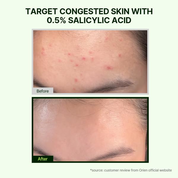 Orien Mugwort Cleansing Foam 150ml | Daily Makeup & Blackhead Removal