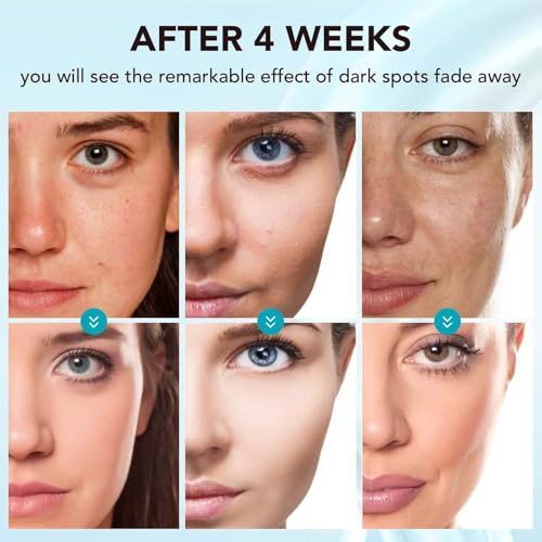 Skin Bleaching Cream for Dark Spots & Uneven Tone - 1.7 fl oz