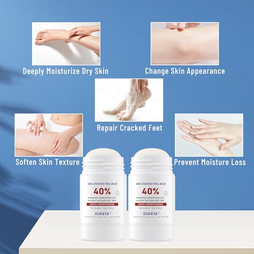 OUKEYA 40% Urea Cream Stick Pack of 2 – Moisturizing for Dry, Cracked Skin