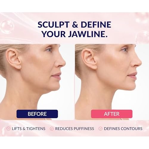 Stylia V Line Lifting Collagen Mask - Lift, Firm & Contour Jawline - Tightening Double Chin Strap with Hyaluronic Acid & Aloe - Neck Tightening and Lifting Mask - Jawline Shaper Face Lift Tape (10PC)