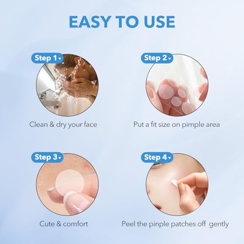 QUSTERE Hydrocolloid Pimple Patches - 282 Count in 3 Shapes