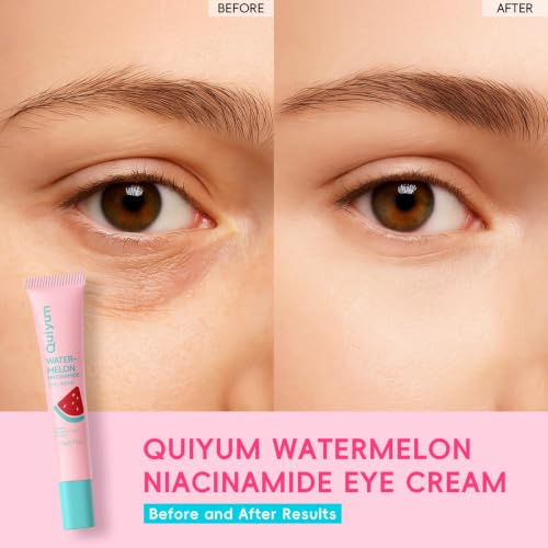 Watermelon Eye Cream with Niacinamide & Hyaluronic Acid - 0.71 oz | Revitalizes Tired Eyes