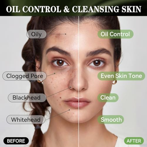 Wonshine Charcoal Blackhead Remover Mask with Brush – Deep Pore Cleansing 3.53oz