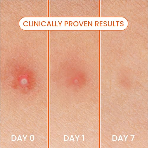 Bioré Hydrocolloid Blemish Patches - Ultra-Thin Spot Treatment, 30 Ct