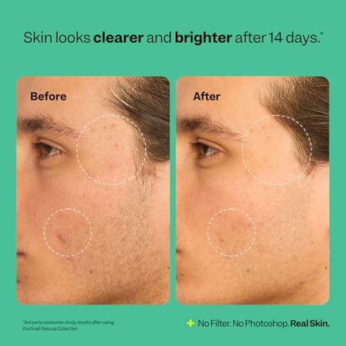 Snail Mucin Toner for Clear Skin - Hydrating Korean Beauty, 4.05 oz