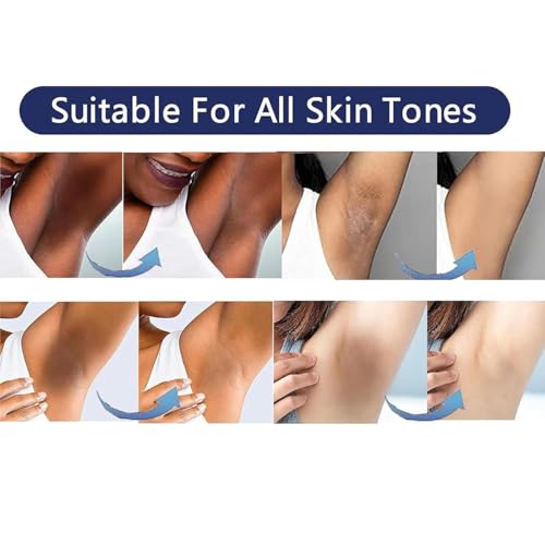 Vcetree Intimate Skin Lightening Cream for Dark Spots & Body Areas (1 fl oz)