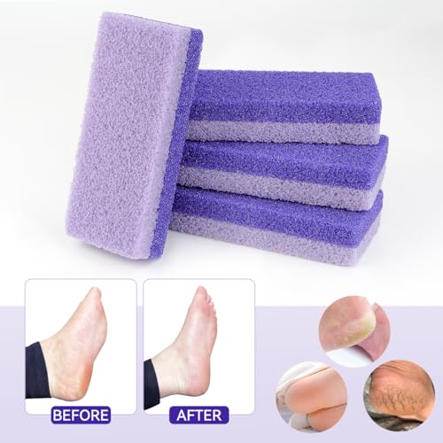 4 Pcs Premium Pumice Stone Set for Callus Removal and Foot Scrubbing