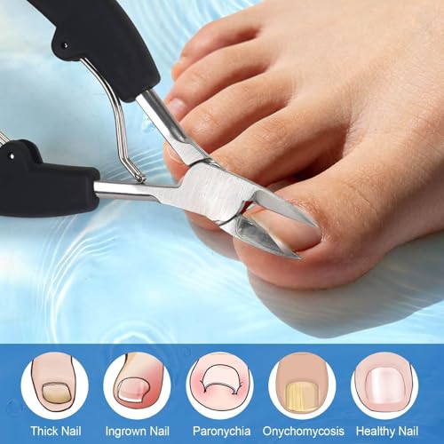 Professional Stainless Steel Toenail Clippers for Ingrown Nails