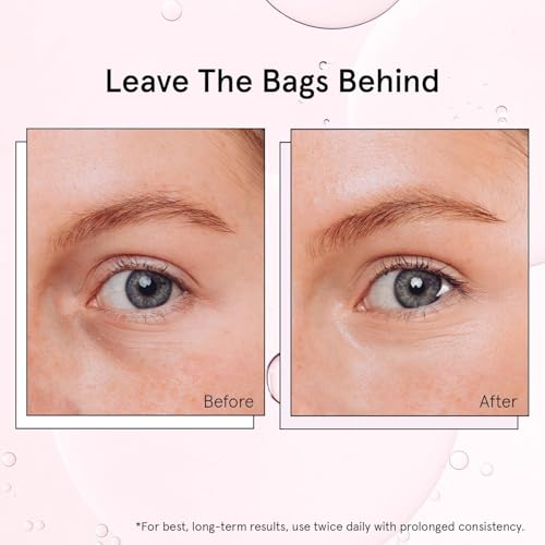 grace & stella Under Eye Brightener Roller - Airplane Travel Essentials - Travel Size Toiletries - Retinol & Caffeine Eye Serum for Puffiness, Dark Circles, Wrinkles - Vegan Skincare (15ml / 0.51floz)