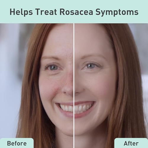 PROcure Rosacare Gentle Cream Cleanser with Hyaluronic Acid