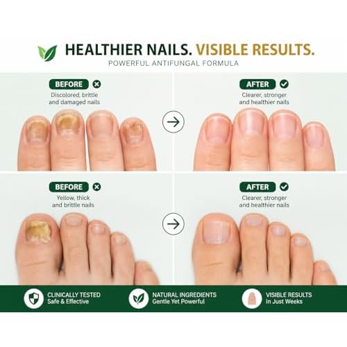 Nail Treatment, Tratamiento Para U?as, Extra Strength Nail Renewal, Made in USA