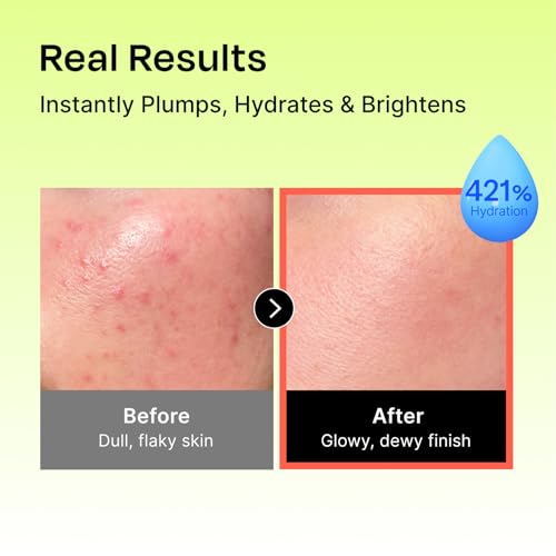 Celladix Hyaluronic Intense Cream – Deep Hydrating Face Moisturizer