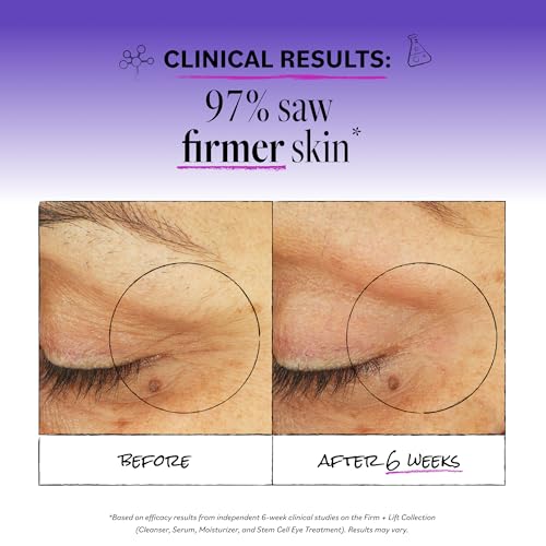 Derma E Stem Cell Eye Cream - Firming & Lifting Treatment, 0.5 oz