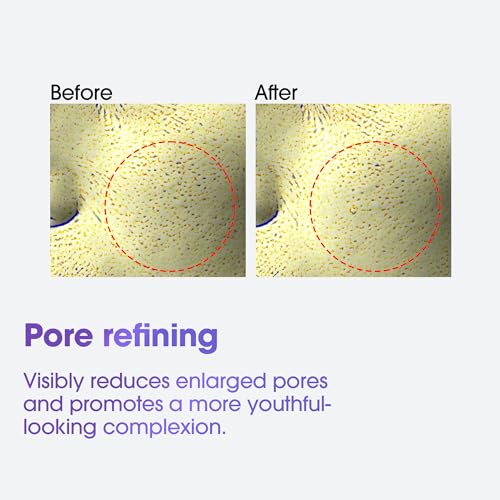 SOME BY MI Retinol Eye Cream Pack of 1 – Brightening Anti-Aging Under Eye Treatment