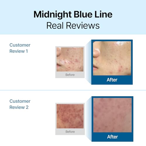 DearKlairs Midnight Blue Calming Cream - Mini Face Moisturizer, 0.7 oz