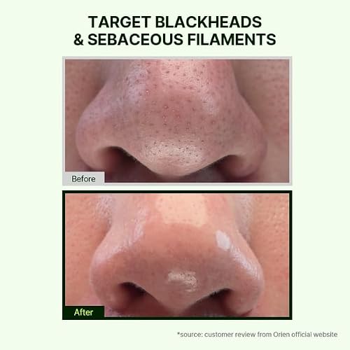 Orien Mugwort Zero Film Cleansing Oil 6.76 fl.oz. 200ml ¤ÓDaily Makeup Blackhead Removal No pore clogging Korean skincare double cleansing