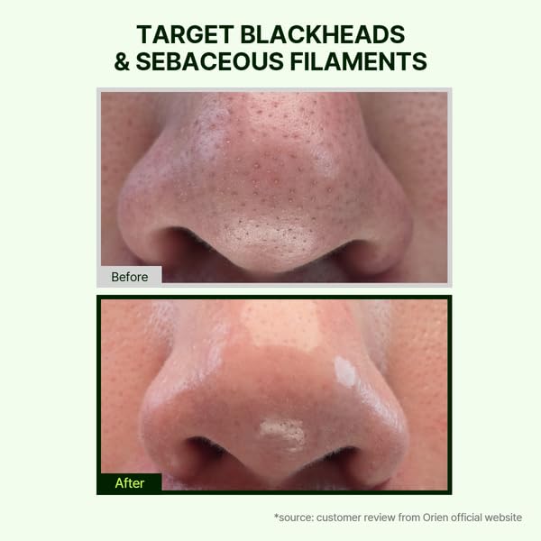 Mugwort Cleansing Oil - Daily Makeup & Blackhead Removal | 6.76 fl. oz. Korean Skincare