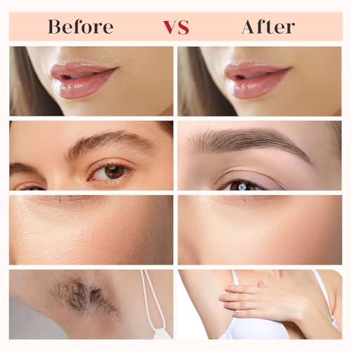 BECHY Replacement Heads for Gen 3 Finishing Touch Flawless Hair Remover (4 Pack)