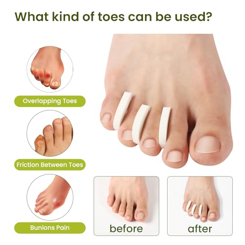 Bukihome 100 Pack Foam Toe Spacers for Pain Relief and Comfort - Reusable Toe Separators for Women and Men