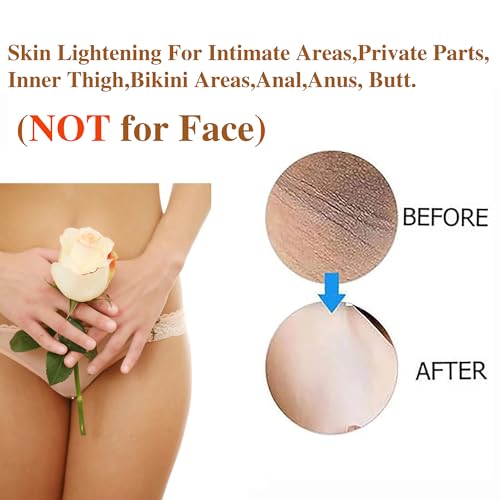 SMILEFACE Skin Lightening Cream for Private Parts, Underarms & Dark Spots