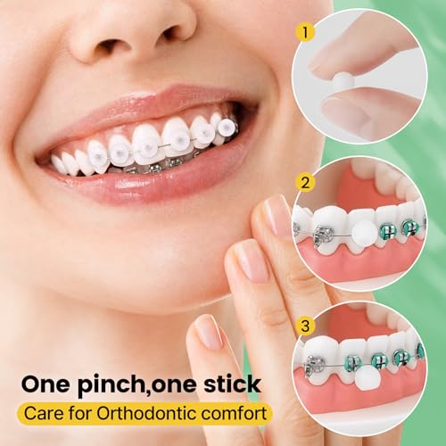 VINSULLA Orthodontic Wax for Braces - Mint Flavor, 90 Count