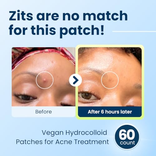 CLEAN SKIN CLUB Invisible Vegan Pimple Patches - Hydrocolloid Acne Treatment