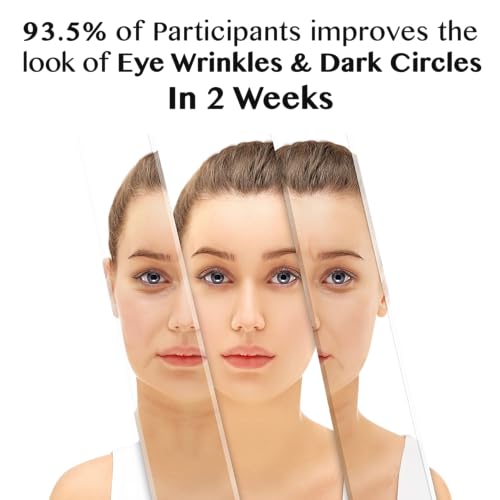 Lamelin Retinol Eye Cream Roller for Dark Circles & Puffiness
