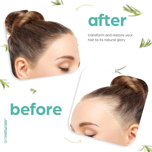 ArtNaturals Rosemary & Castor Oil Set for Hair Growth - 4 oz