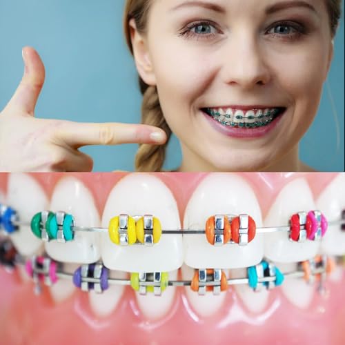 1040 Pcs Multi-Color Orthodontic Ligature Ties for Braces